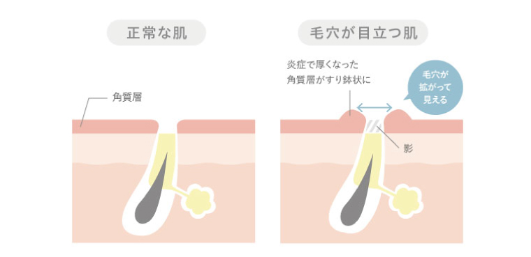 イメージ写真