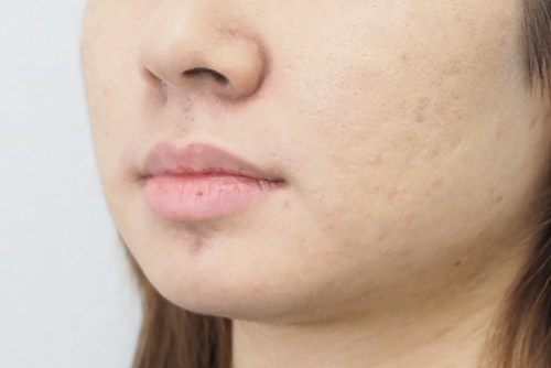 ミネラルファンデーション使用